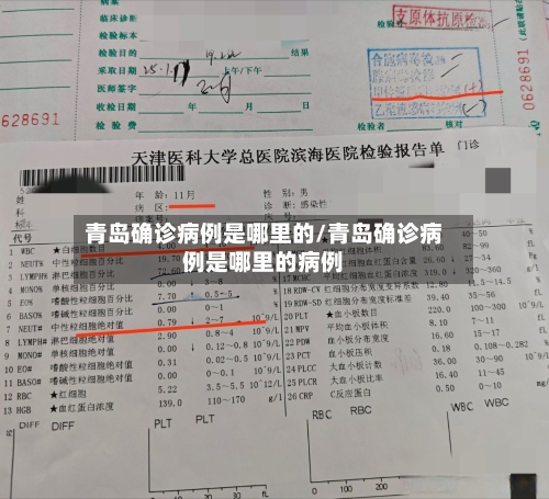 青岛确诊病例是哪里的/青岛确诊病例是哪里的病例-第2张图片