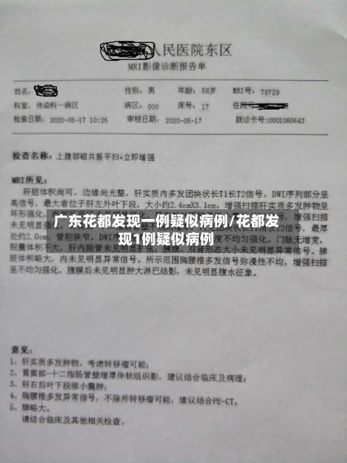 广东花都发现一例疑似病例/花都发现1例疑似病例-第3张图片