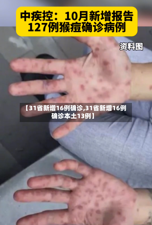 【31省新增16例确诊,31省新增16例确诊本土13例】-第3张图片