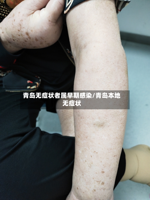 青岛无症状者属早期感染/青岛本地无症状-第2张图片